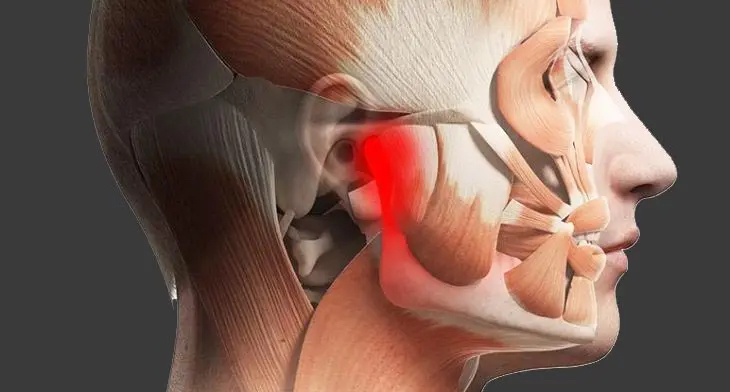 Tecnología para distinguir la artritis idiopática juvenil de otras causas en la destrucción progresiva de la ATM