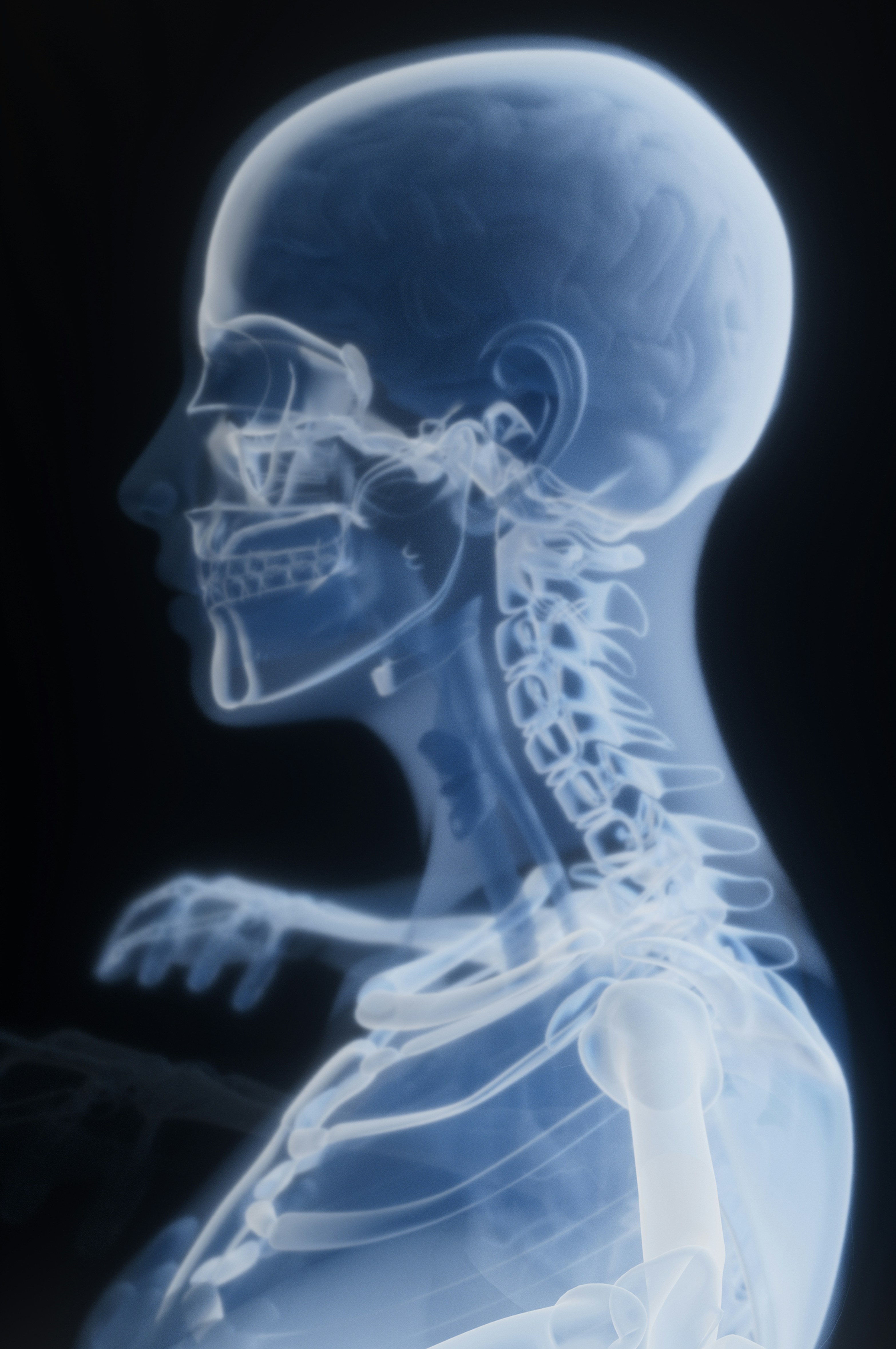 Inteligencia artificial en Cirugía maxilofacial: segmentación de imágenes, planificación virtual y predicción de resultados